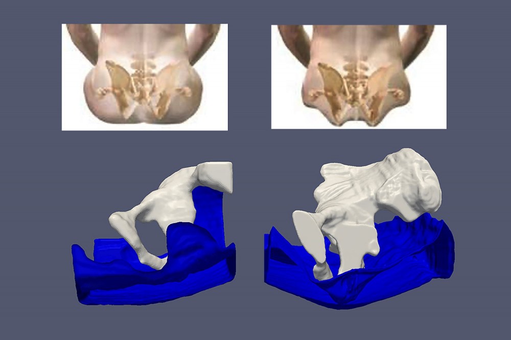 Two butt scans with renderings of butt adipose tissue conforming to a chair when seated